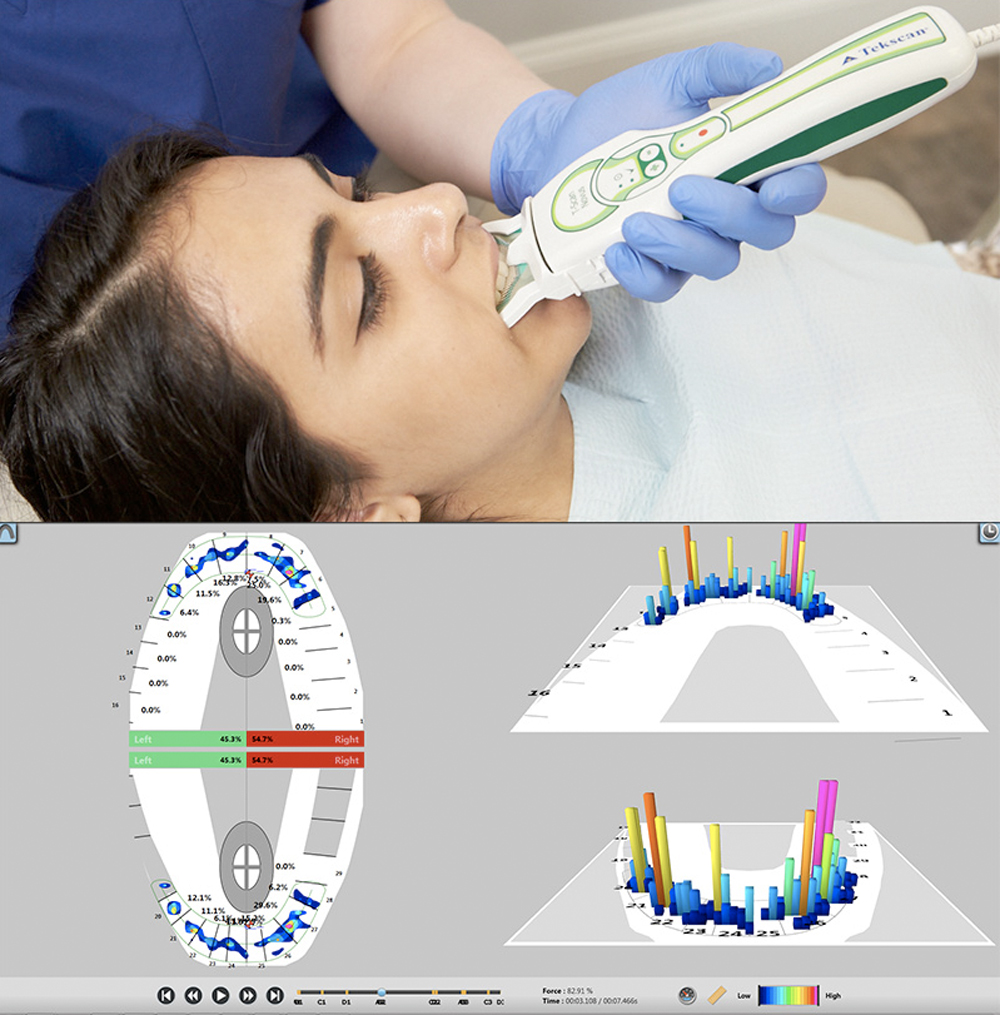 Sistema T-SCAN
