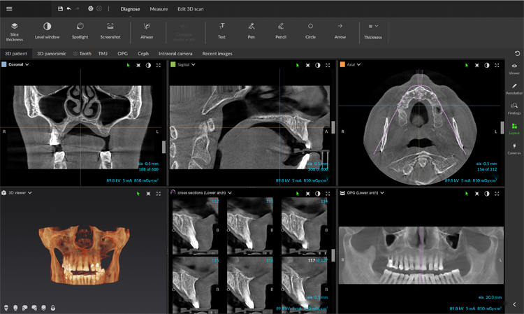 Exame Radiologia Digital 3D